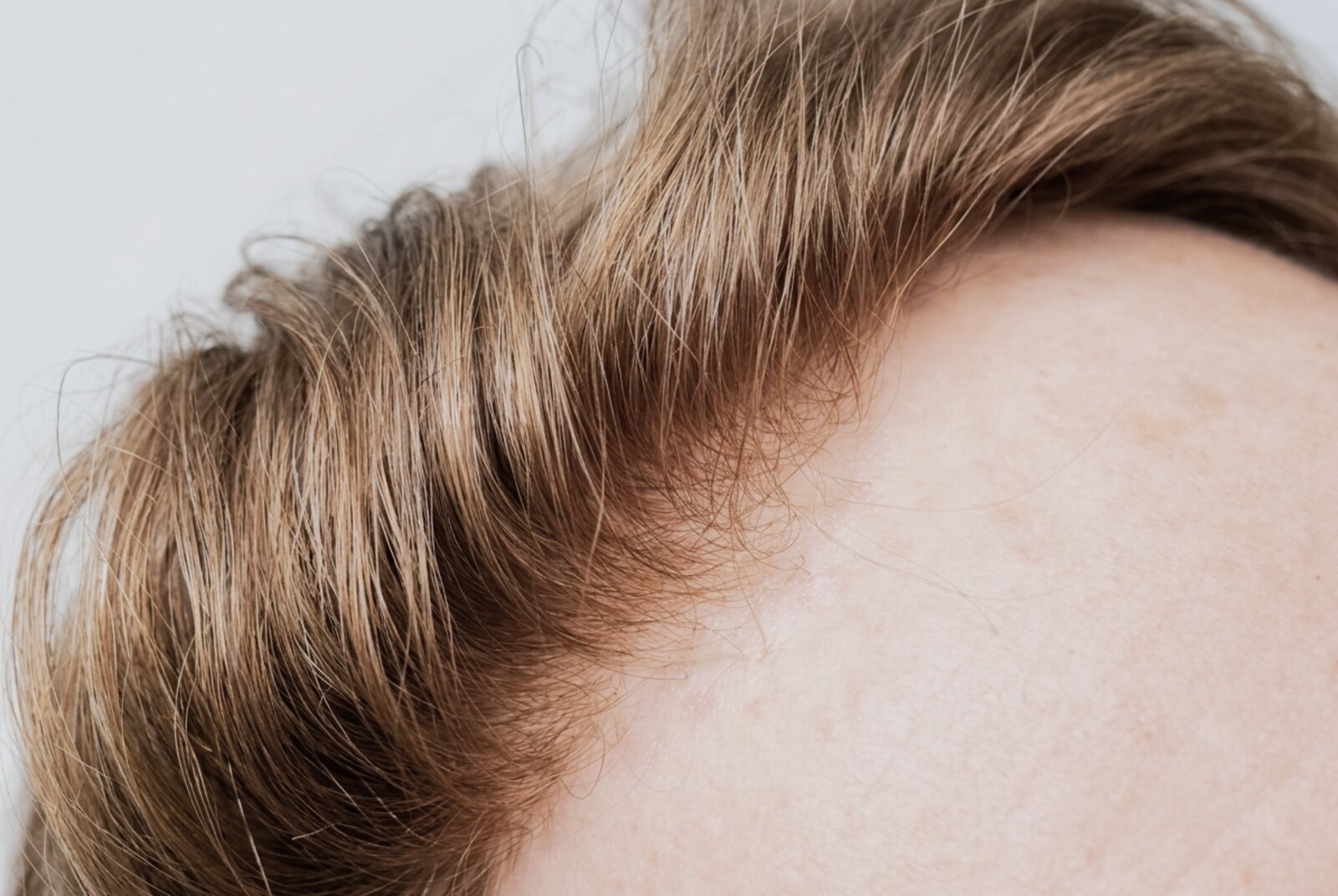 Dichteverlauf eines AvexisHAIR-Systems