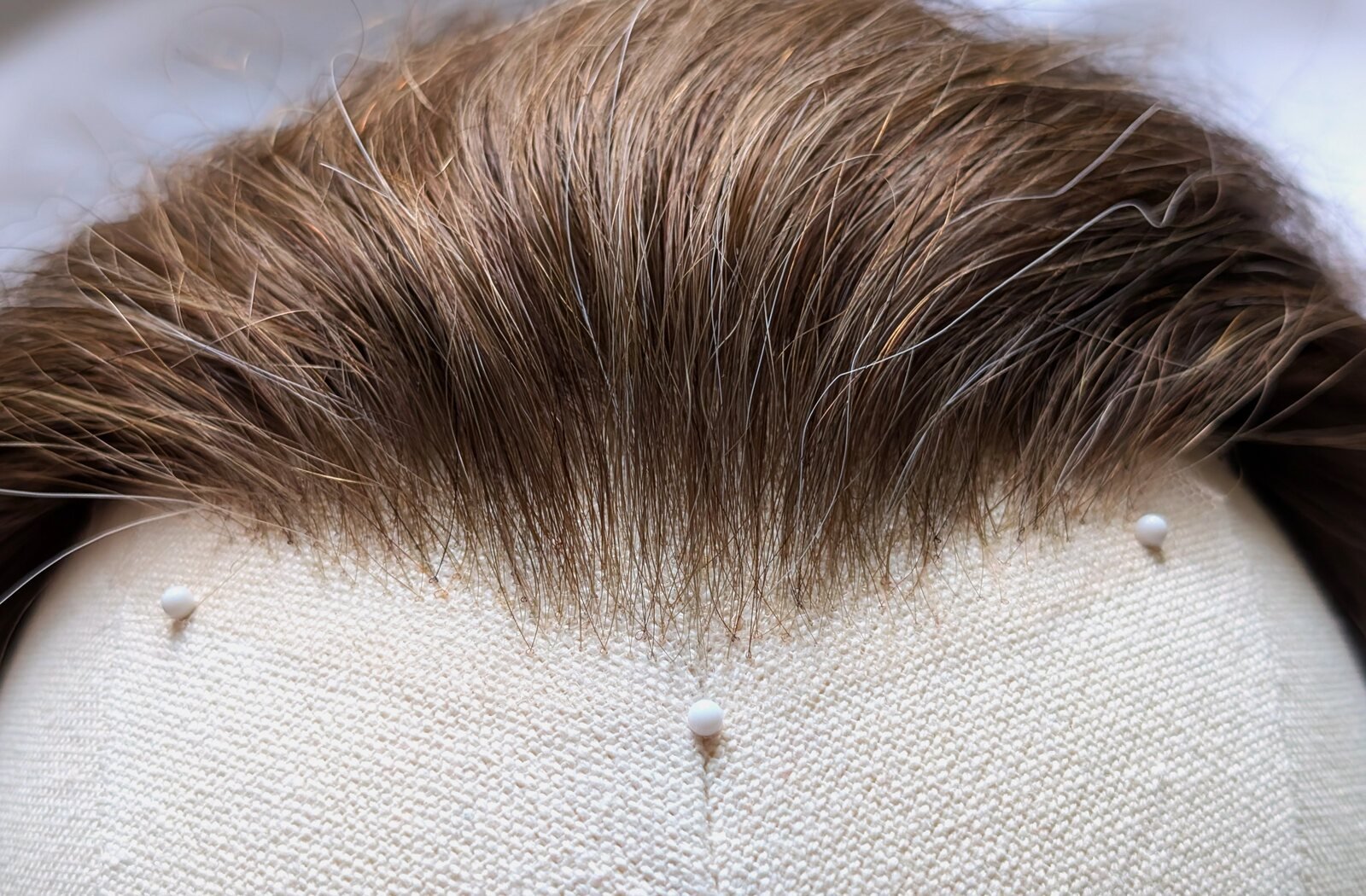 Haarlinie eines AvexisHAIR-Systems aus der Nähe